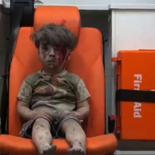 Omran Daqneesh, di 5 anni, richiama l'attenzione del mondo sugli orrori siriani.